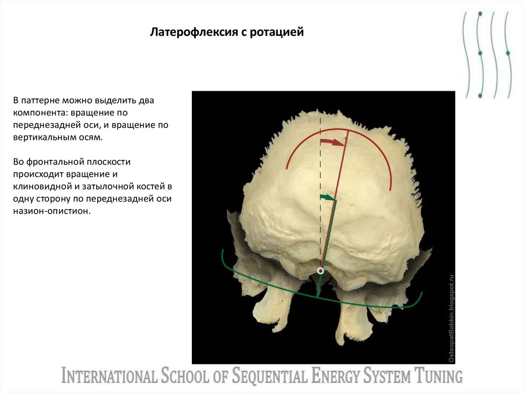 Латерофлексия с ротацией