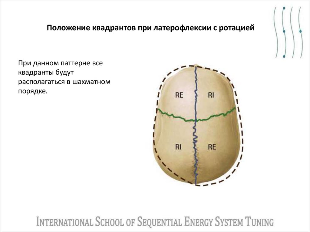 Положение квадрантов при латерофлексии с ротацией
