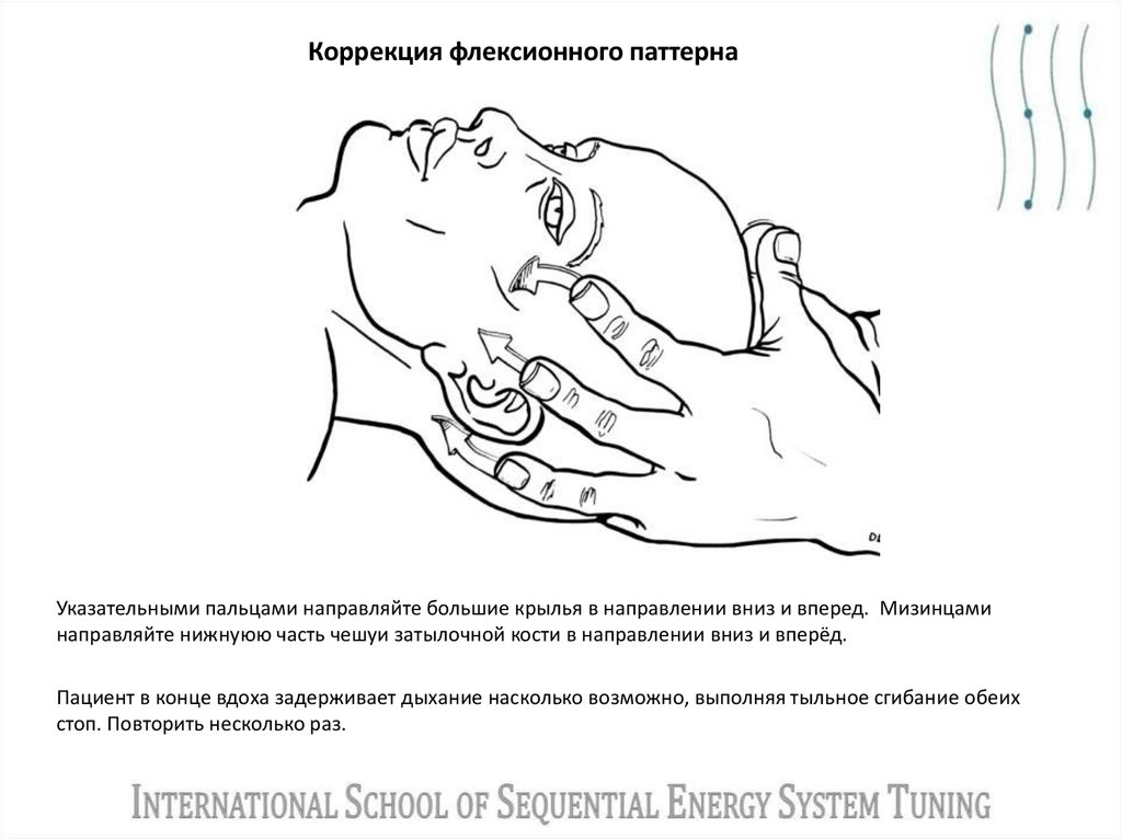 Коррекция флексионного паттерна