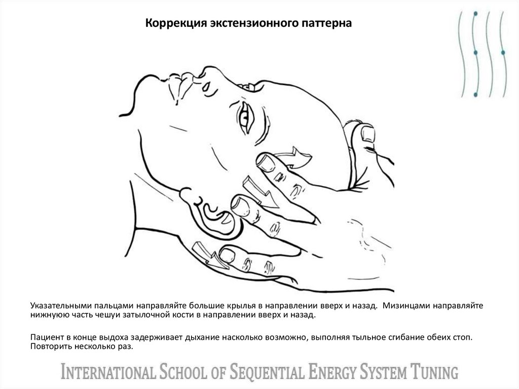 Коррекция экстензионного паттерна