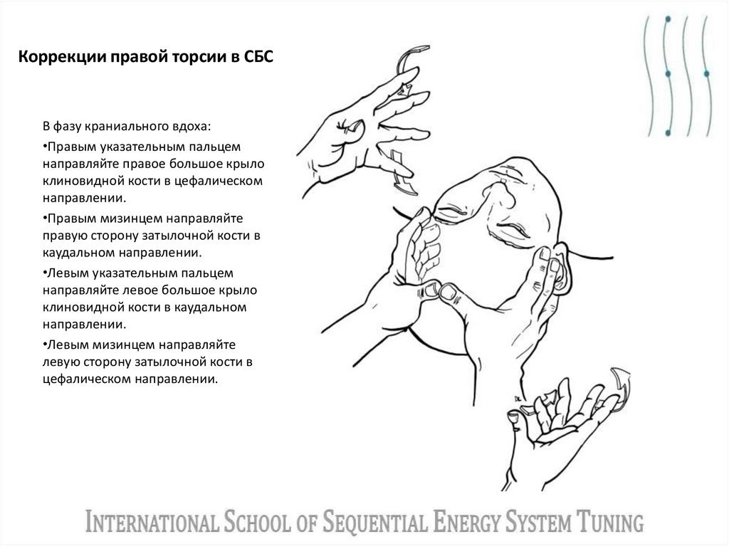 Коррекции правой торсии в СБС