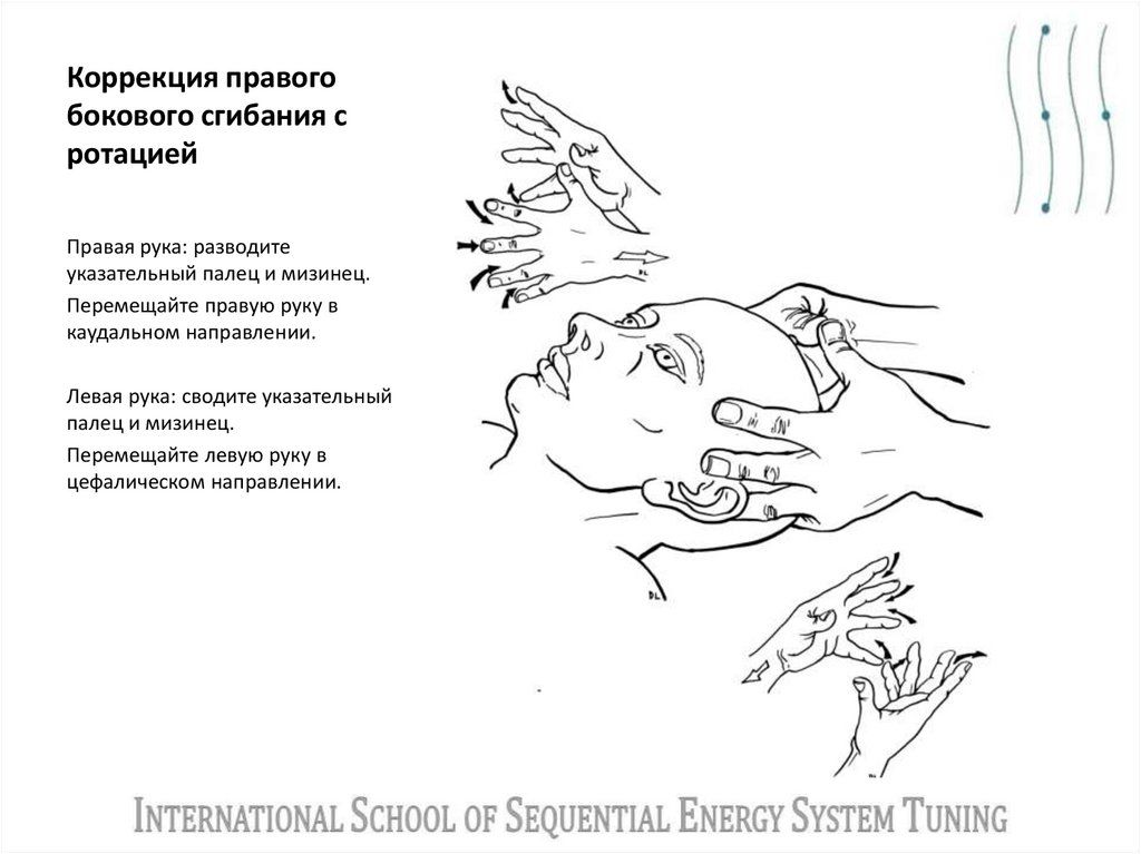 Коррекция правого бокового сгибания с ротацией