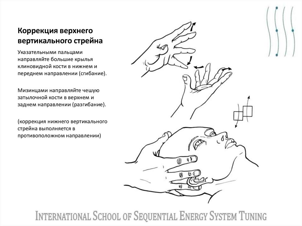 Коррекция верхнего вертикального стрейна
