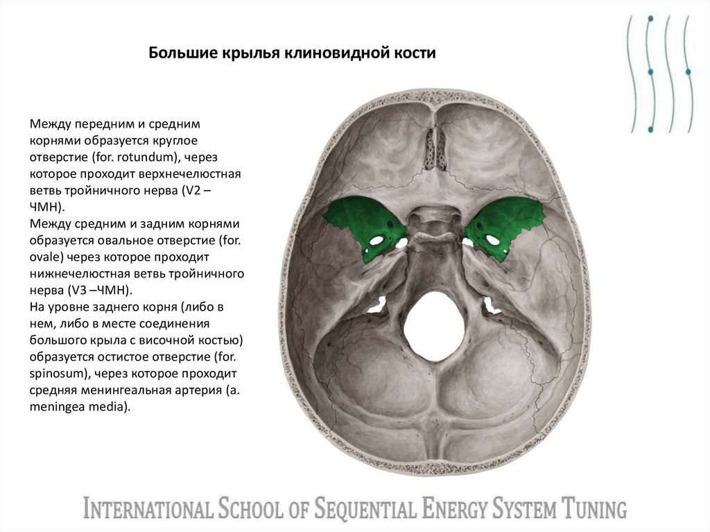 Большие крылья клиновидной кости
