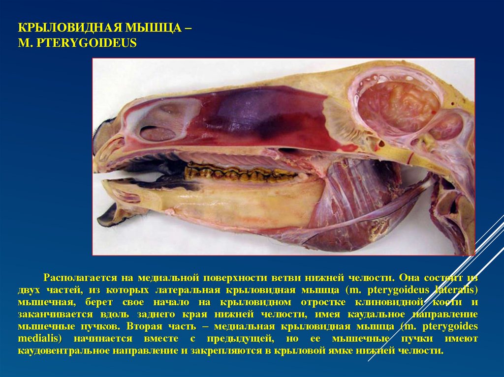 Крыловидная мышца – m. pterygoideus