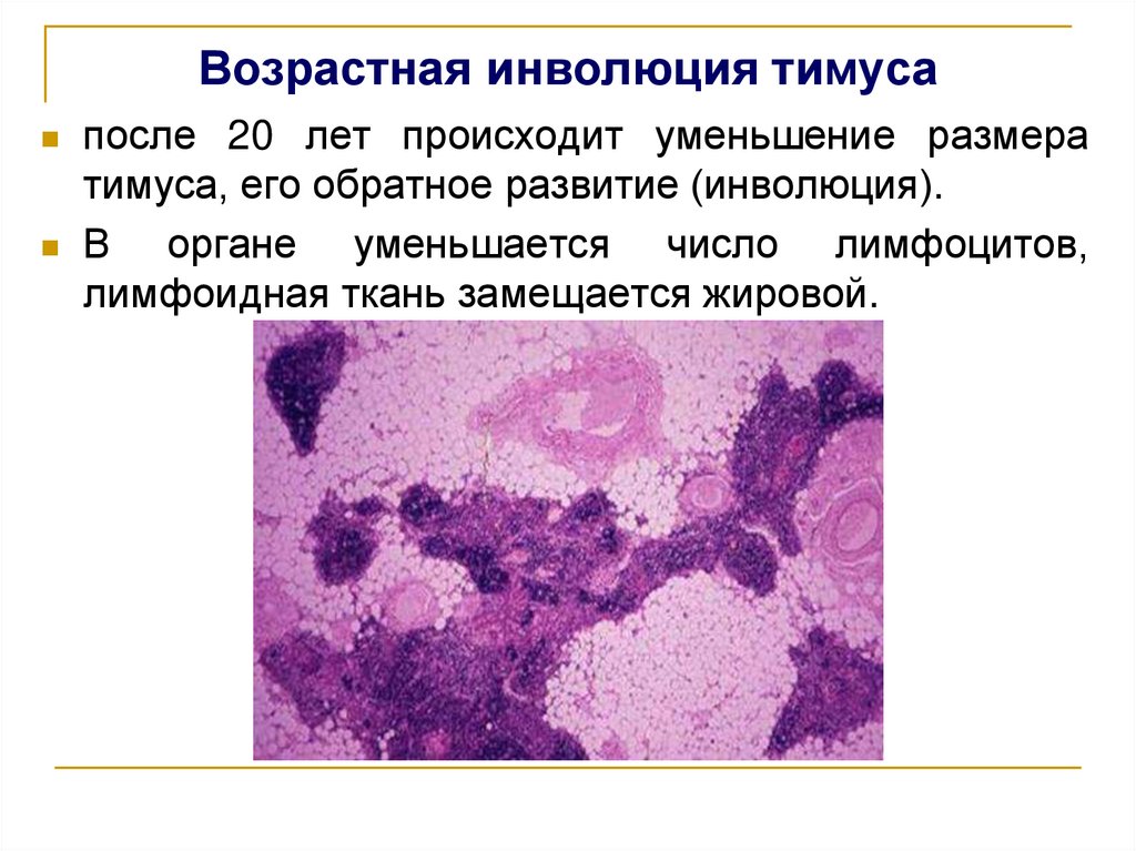 Возрастная инволюция тимуса