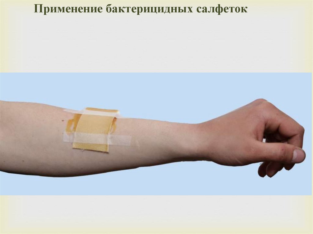 Применение бактерицидных салфеток