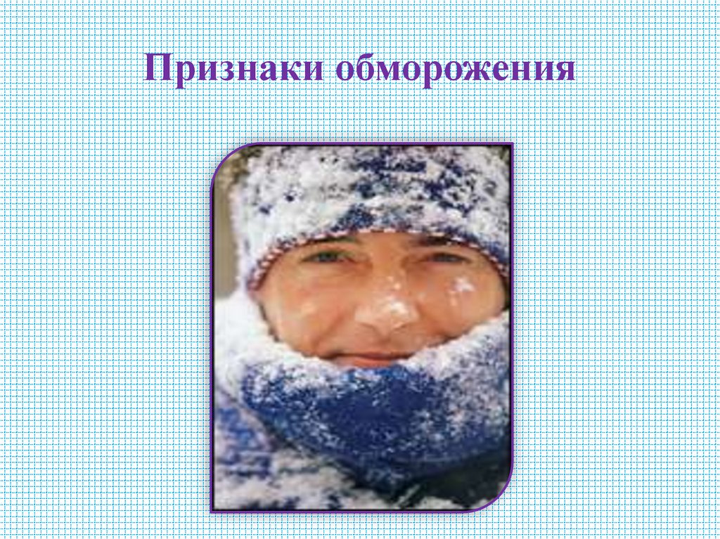 Признаки обморожения