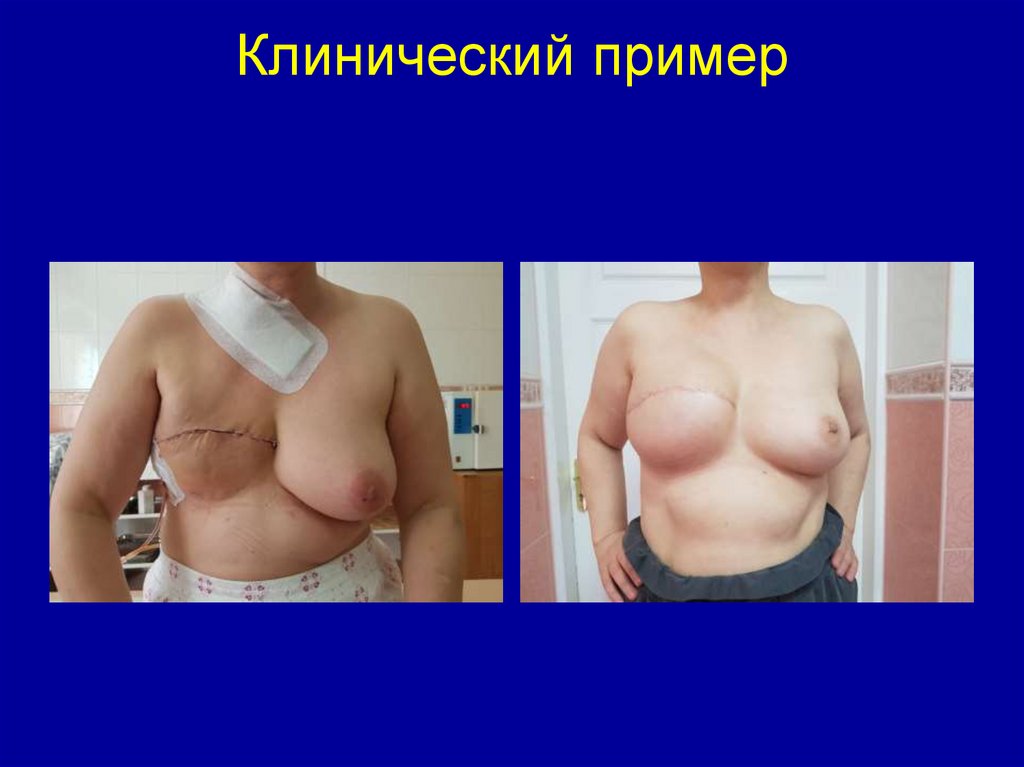 Клинический пример