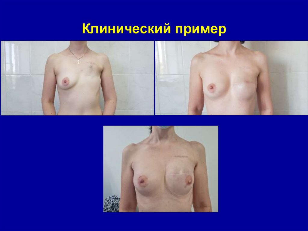 Клинический пример