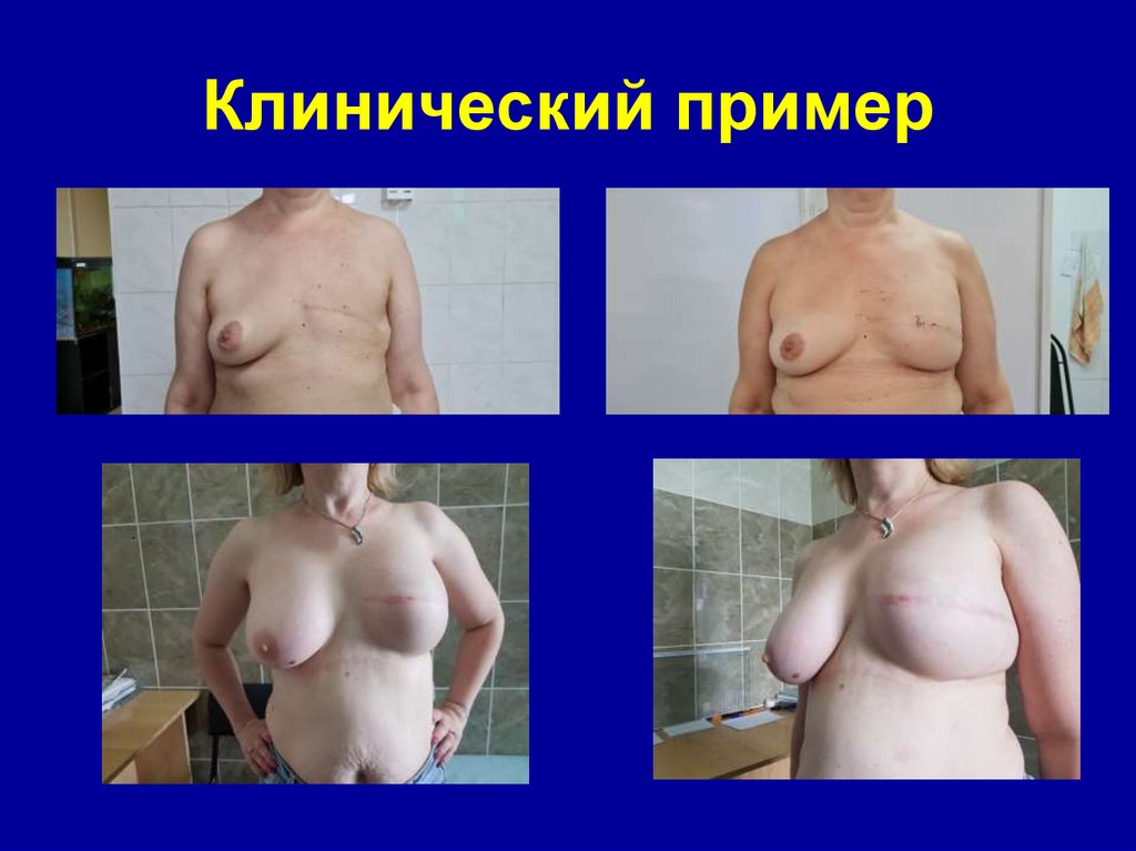 Клинический пример