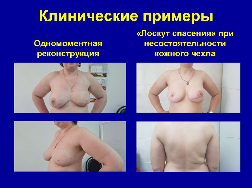 Клинические примеры