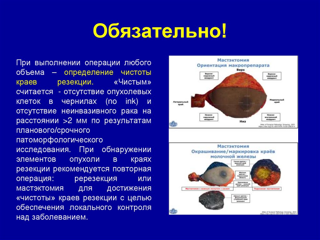 Обязательно!