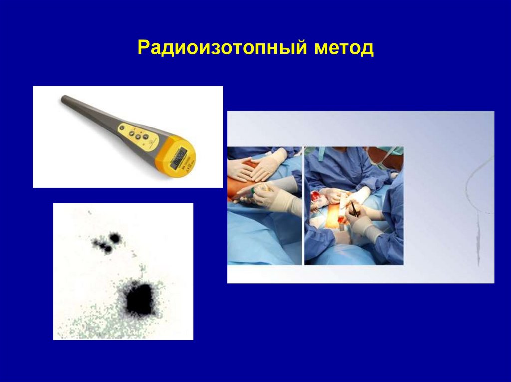 Радиоизотопный метод