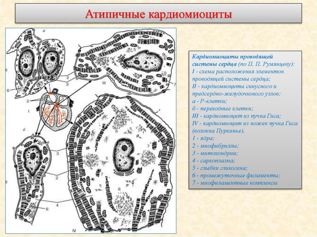 Атипичные кардиомиоциты
