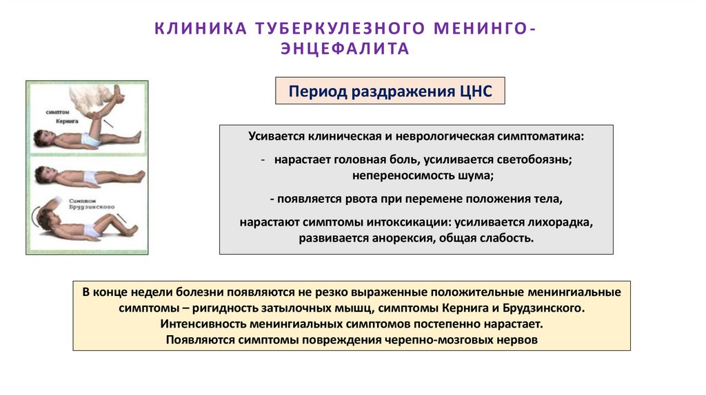 КЛИНИКА ТУБЕРКУЛЕЗНОГО МЕНИНГО-ЭНЦЕФАЛИТА