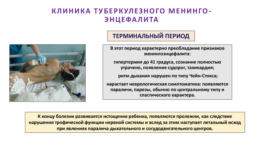 КЛИНИКА ТУБЕРКУЛЕЗНОГО МЕНИНГО-ЭНЦЕФАЛИТА