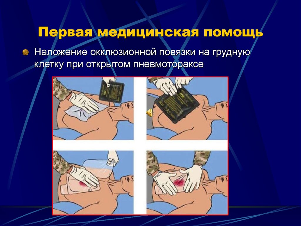 Первая медицинская помощь