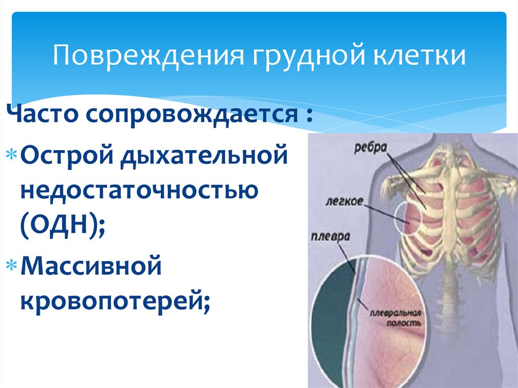 Повреждения грудной клетки