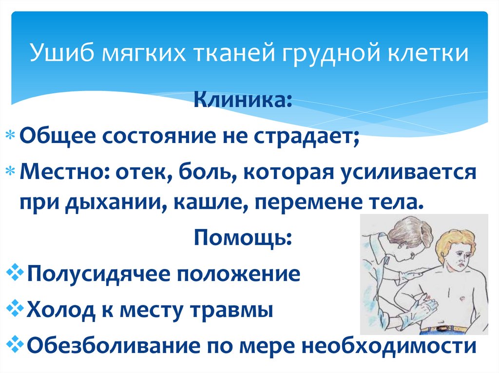 Ушиб мягких тканей грудной клетки