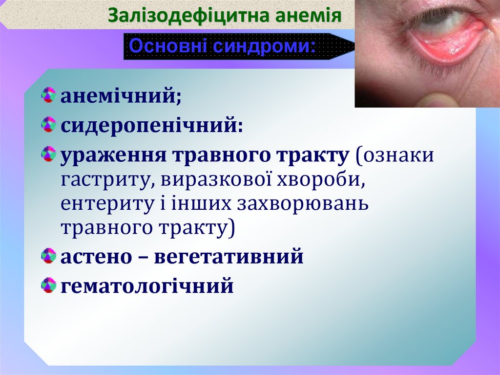 Залізодефіцитна анемія