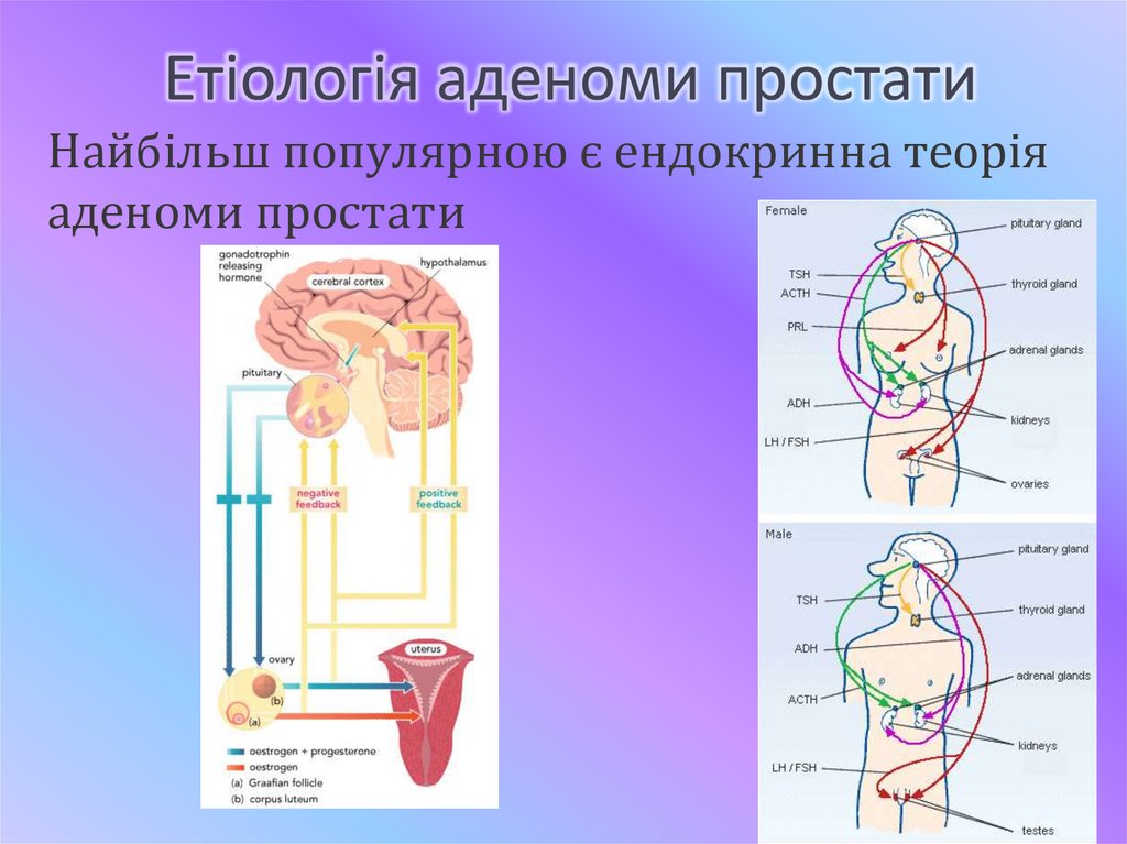 Етіологія аденоми простати