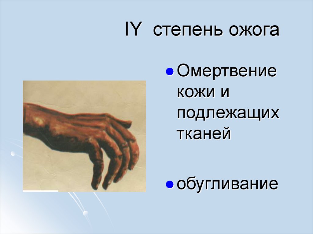 IY степень ожога