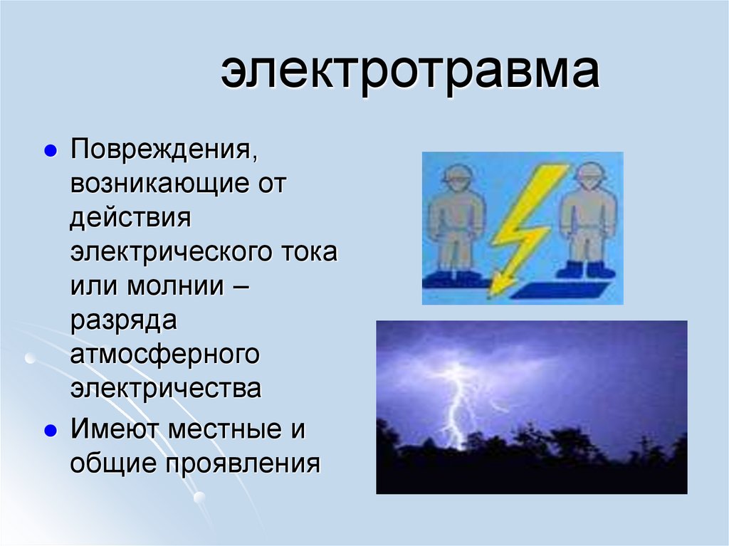 электротравма