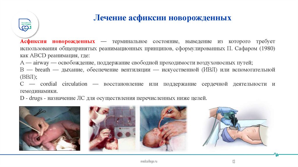 Лечение асфиксии новорожденных