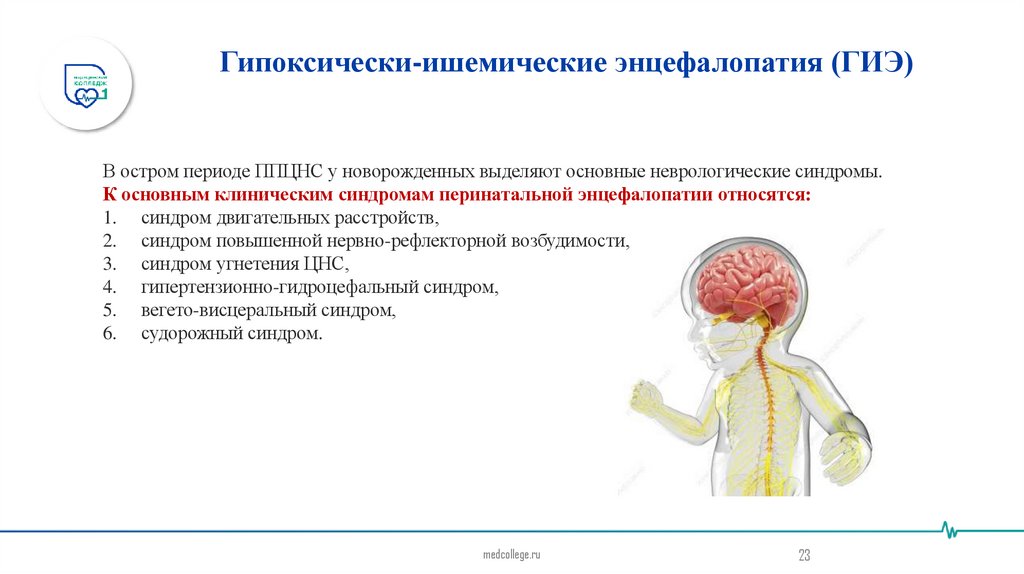 Гипоксически-ишемические энцефалопатия (ГИЭ)