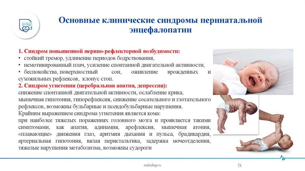 Основные клинические синдромы перинатальной энцефалопатии