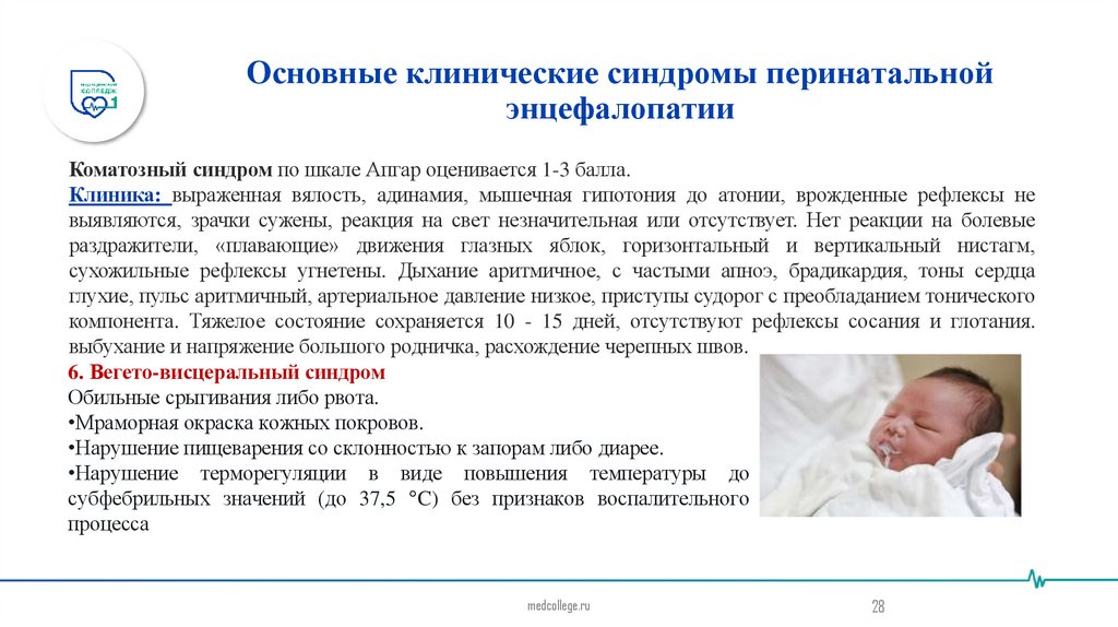 Основные клинические синдромы перинатальной энцефалопатии