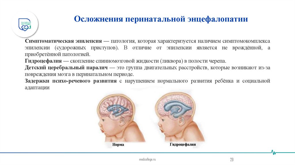 Осложнения перинатальной энцефалопатии