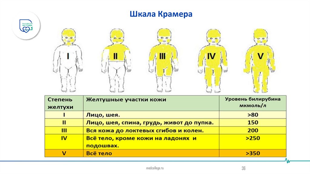 Шкала Крамера