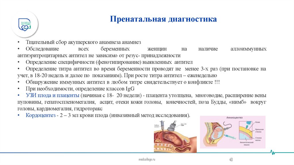 Пренатальная диагностика