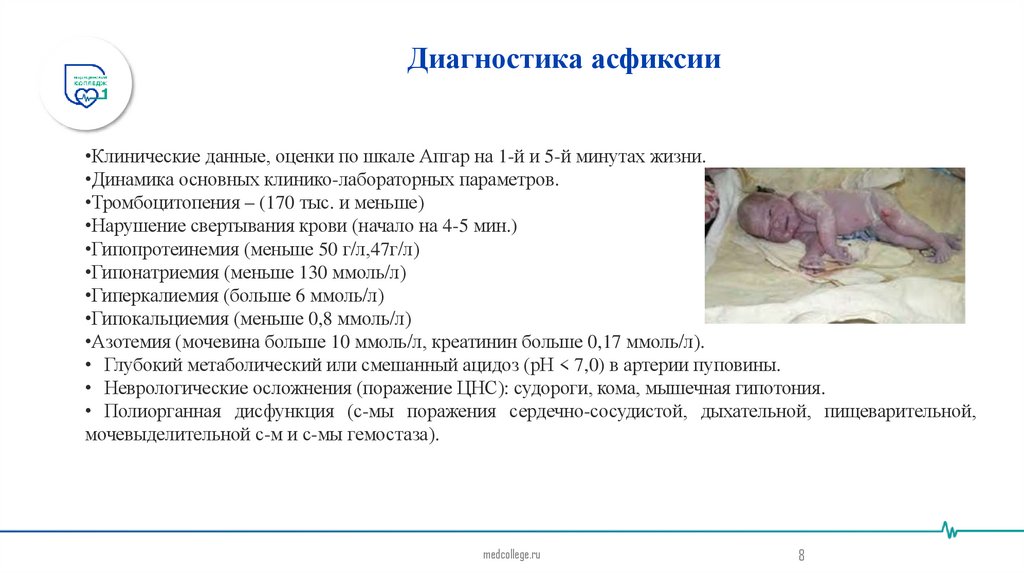 Диагностика асфиксии