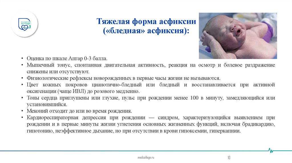 Тяжелая форма асфиксии («бледная» асфиксия):