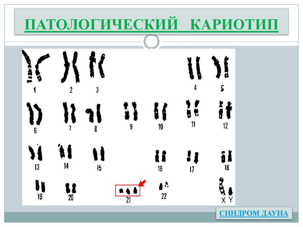 ПАТОЛОГИЧЕСКИЙ КАРИОТИП