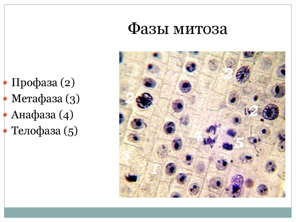 Фазы митоза