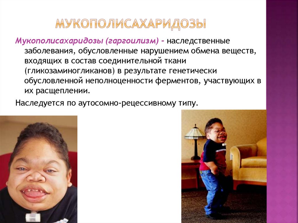 Мукополисахаридозы