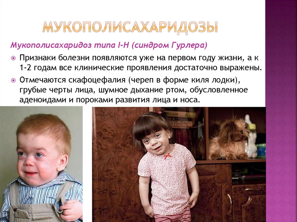 Мукополисахаридозы