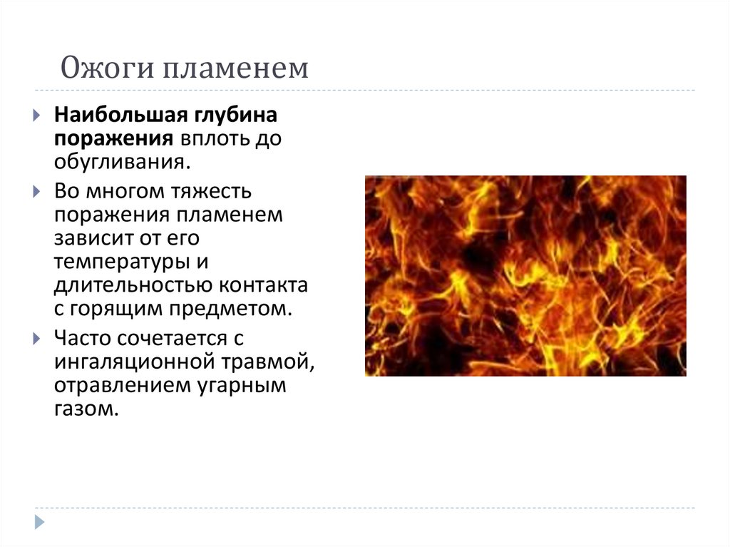 Ожоги пламенем