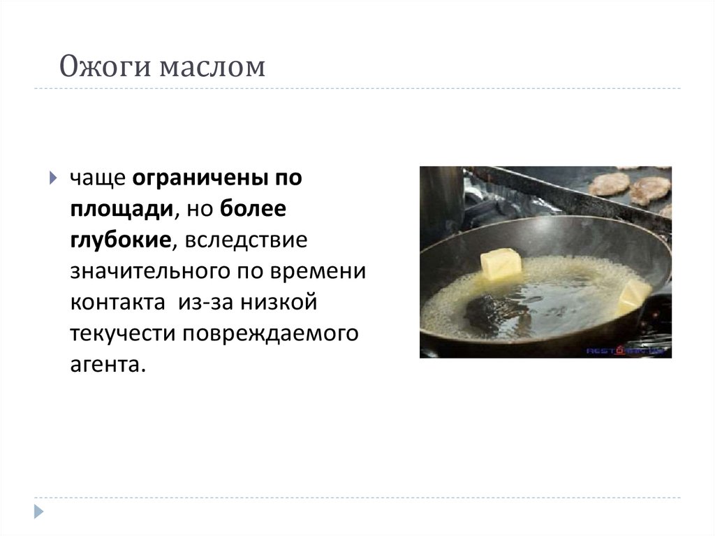 Ожоги маслом
