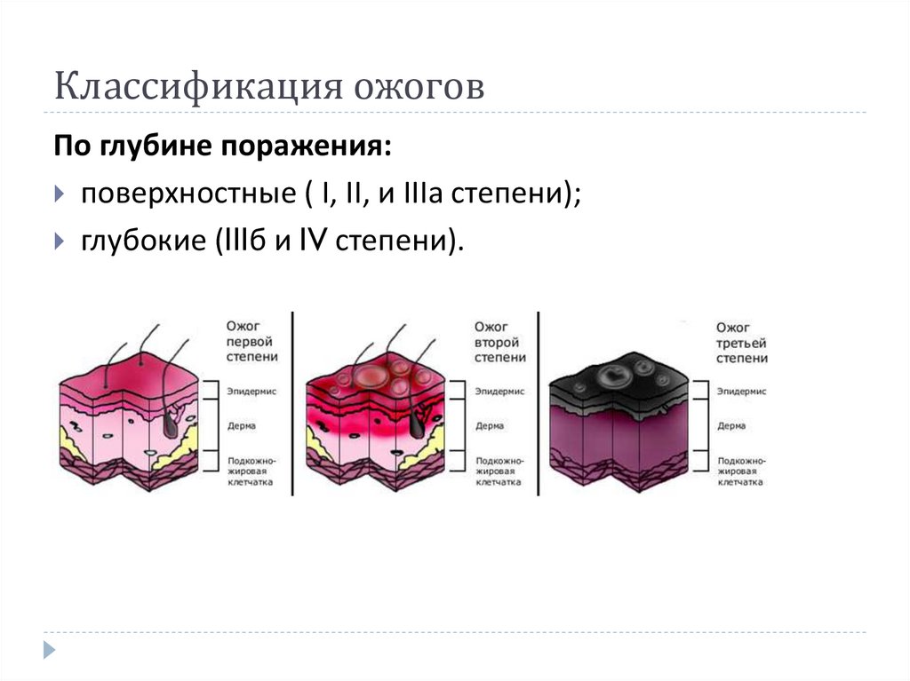 Классификация ожогов