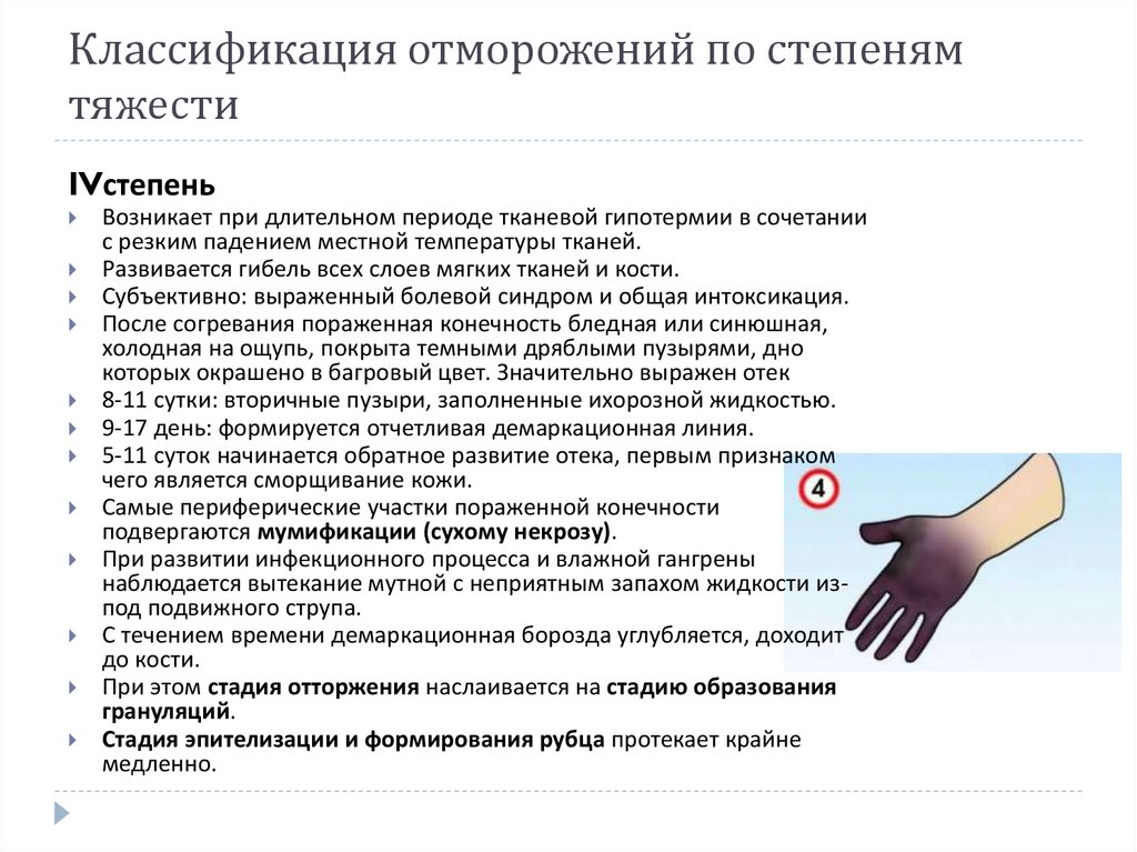 Классификация отморожений по степеням тяжести