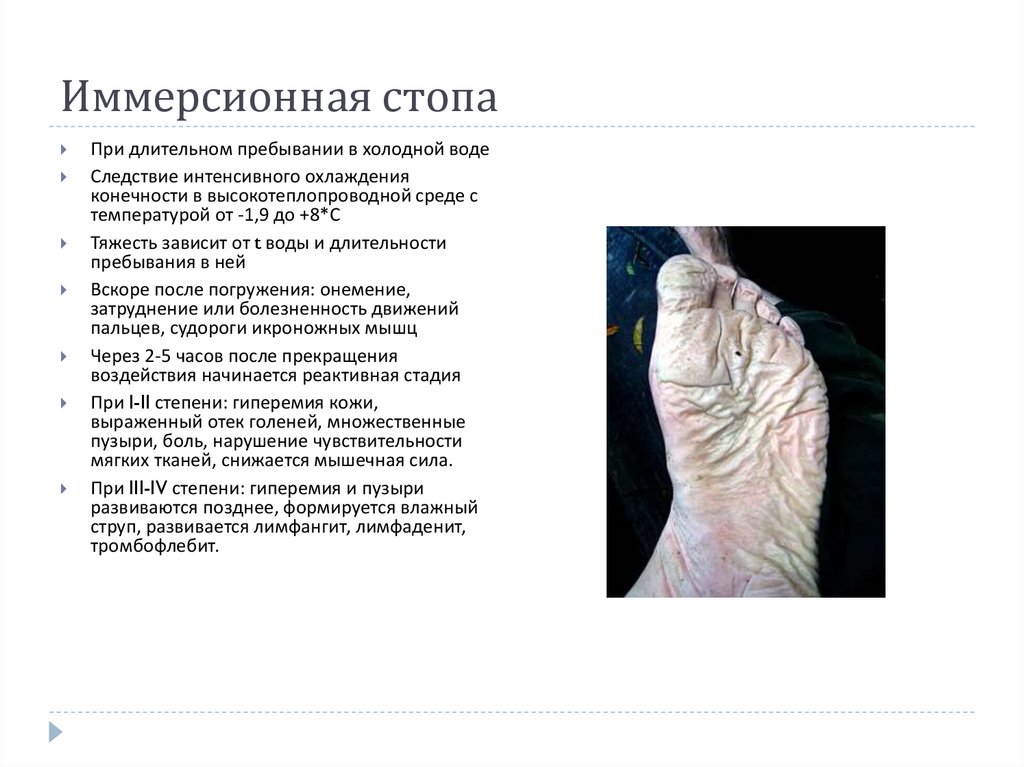 Иммерсионная стопа