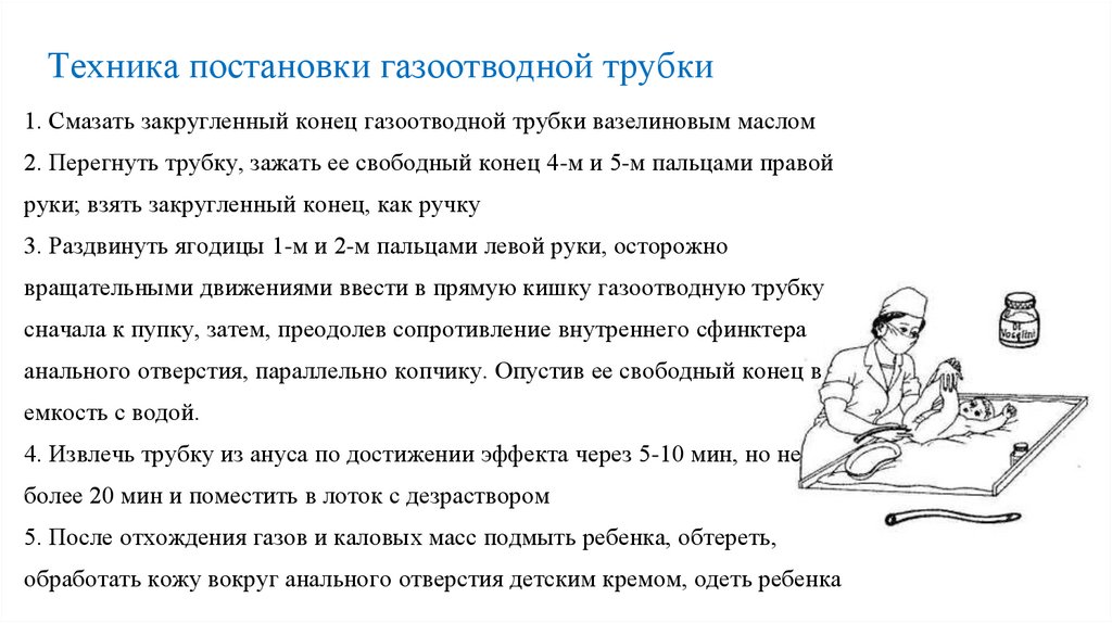Техника постановки газоотводной трубки