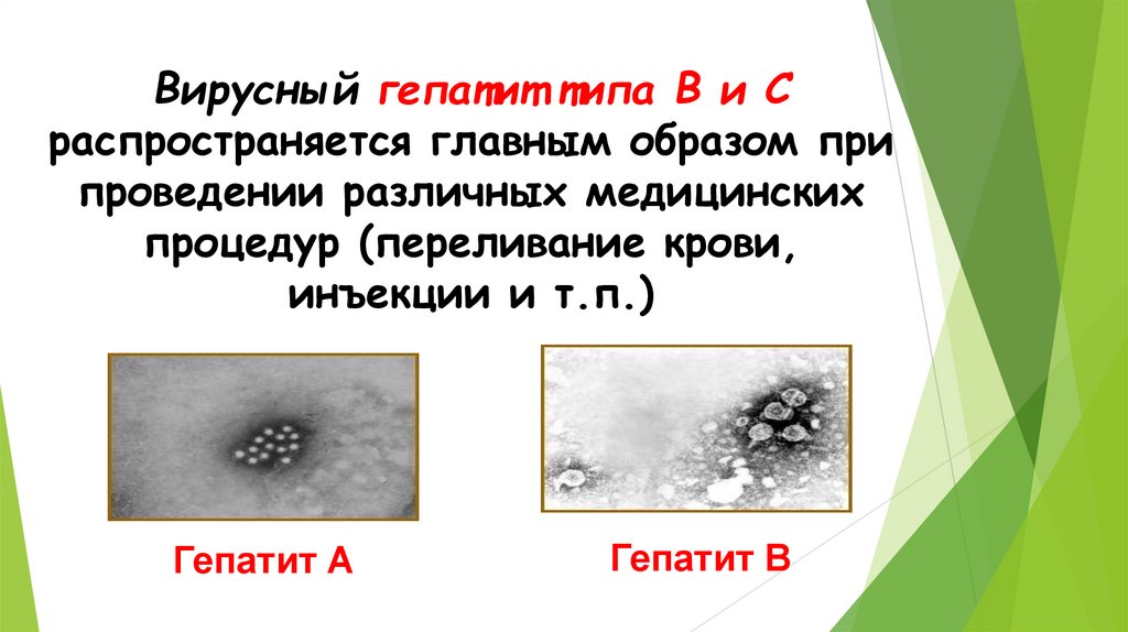 Вирусный гепатит типа В и С распространяется главным образом при проведении различных медицинских процедур (переливание крови,