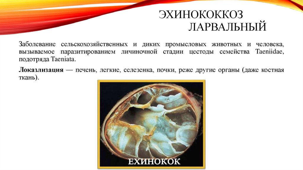ЭХИНОКОККОЗ ЛАРвАЛЬНЫЙ