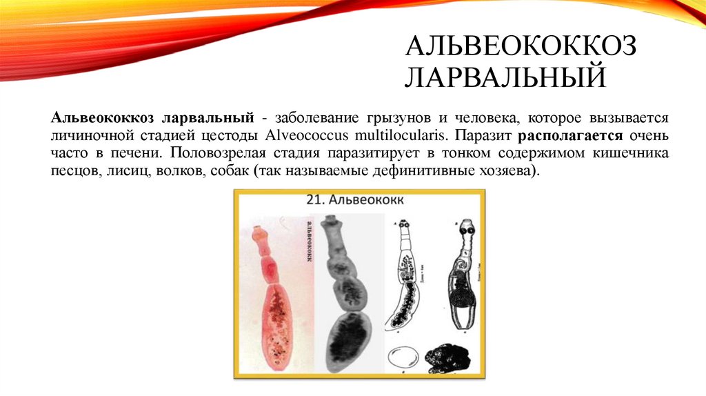 АЛЬВЕОКОККОЗ ЛАРвАЛЬНЫЙ